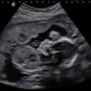 Meet your Posher, Nachoma